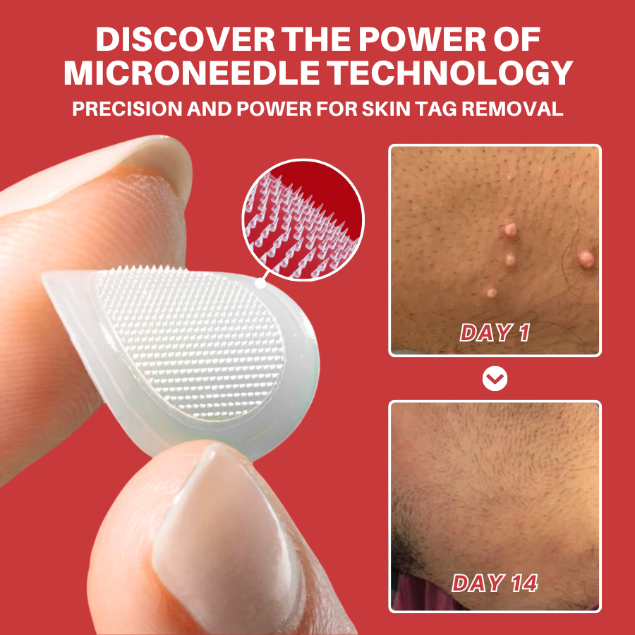 Fivfivgo® MicroNeedle Botanic Skin Tag Removal Patch 29 250716 Fivfivgo MicroNeedleBotanicSkinTagRemovalPatch Img3